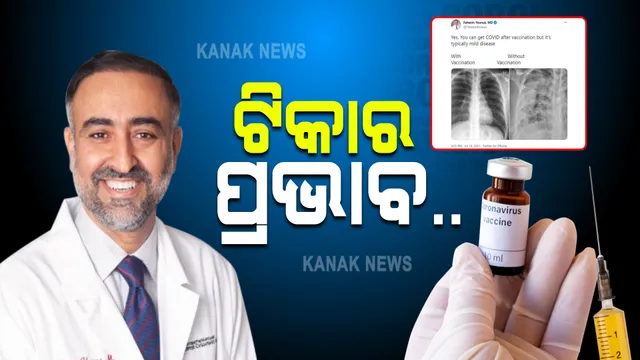 ଟିକା ନେବା ପରେ ହୃଦୟ ଓ ଫୁସଫୁସ୍ ଉପରେ ପଡୁଛି କି ପ୍ରଭାବ ! ଜାଣନ୍ତୁ କ'ଣ କହିଲେ ବରିଷ୍ଠ ସ୍ୱାସ୍ଥ୍ୟ ବିଶେଷଜ୍ଞ ?