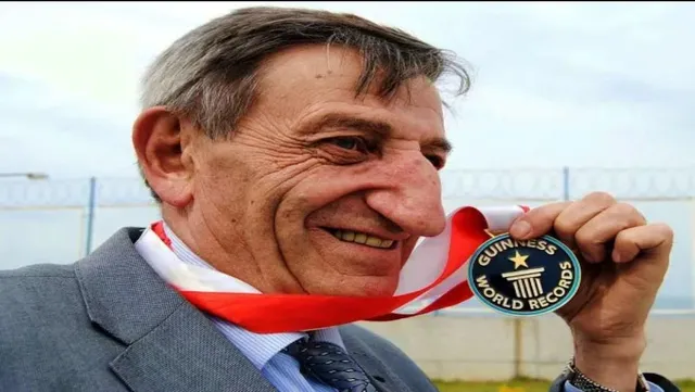 କିଏ ଏହି ବ୍ୟକ୍ତି? ଯାହାଙ୍କ ନାକ ଦୁନିଆରେ ସବୁଠାରୁ ବଡ: ଗିନିଜ ବୁକରେ ବି କରିଛନ୍ତି ରେକର୍ଡ