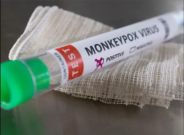 ଉତ୍ତରପ୍ରଦେଶ ଗାଜିଆବାଦରେ ସନ୍ଦିଗ୍ଧ ମଙ୍କିପକ୍ସ ମାମଲା ଚିହ୍ନଟ । ଜଣେ ୫ ବର୍ଷୀୟ ଶିଶୁ ଆକ୍ରାନ୍ତ ହୋଇଥିବା ସନ୍ଦେହ ।