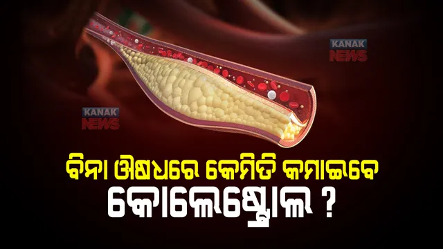 ବିନା ଔଷଧରେ କେମିତି କମାଇବେ କୋଲେଷ୍ଟ୍ରୋଲ? କେଉଁ ଖାଦ୍ୟ ଖାଇବା ଉଚିତ୍, କେଉଁ ଖାଦ୍ୟ ଖାଇବା ଅନୁଚିତ୍? ଜାଣନ୍ତୁ...