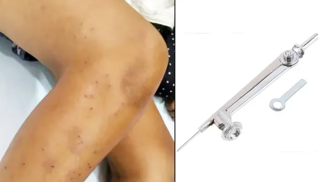 ଚତୁର୍ଥ ଶ୍ରେଣୀ ପିଲାଙ୍କ  ଉନ୍ମତ କାଣ୍ଡ । ସହପାଠୀଙ୍କୁ ୧୦୮ ଥର କମ୍ପାସ ଭୂଷିଦେଲେ