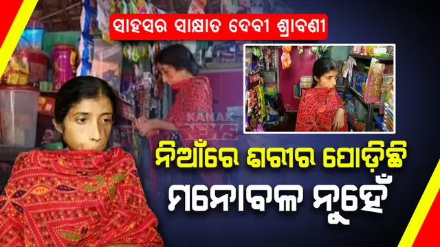 ନିଆଁ ପୋଡ଼ିଦେଇଛି ଶରୀର ,ହେଲେ ଭାଙ୍ଗିନାହାନ୍ତି ମନୋବଳ । ପିଲାଙ୍କୁ ଟ୍ୟୁସନ୍ କରି, ଦୋକାନ ଚଳାଇ ପୋଷୁଛନ୍ତି ପରିବାର ।