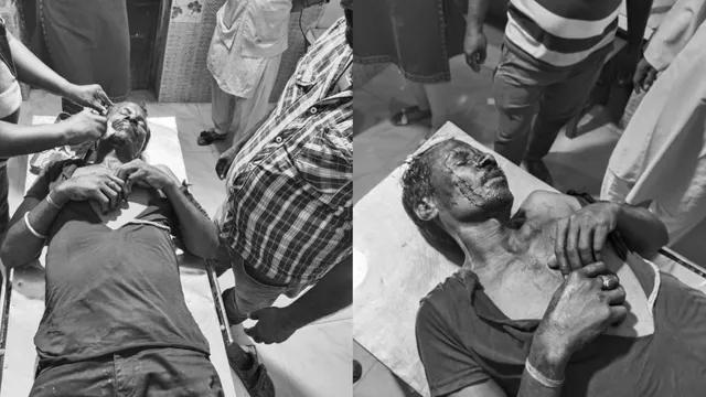 ଘଷିପୁରାରେ ବଦ୍ରି ପାତ୍ରଙ୍କ ସମର୍ଥକଙ୍କ ଗୁଣ୍ଡାଗର୍ଦ୍ଦି ଅଭିଯୋଗ । ଆକ୍ରମଣରେ ସୌମ୍ୟଙ୍କ ସମର୍ଥକ ଗୁରୁତର ।