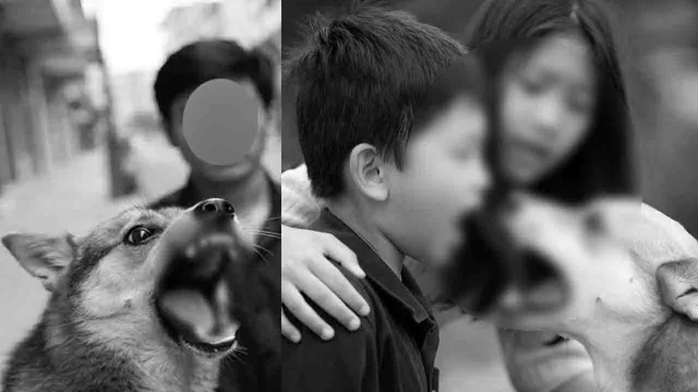 dog-bite-ai-image-child-img