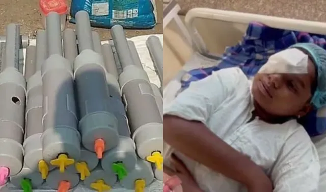 14 kids lose eyesight after playing with 'Carbide Guns' during...