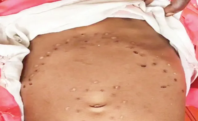 branded with iron rod