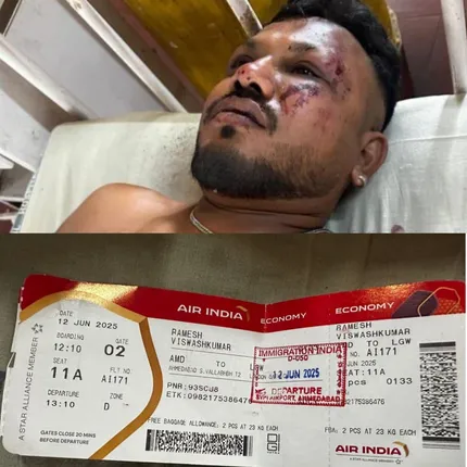 Ahmedabad plane crash survivor