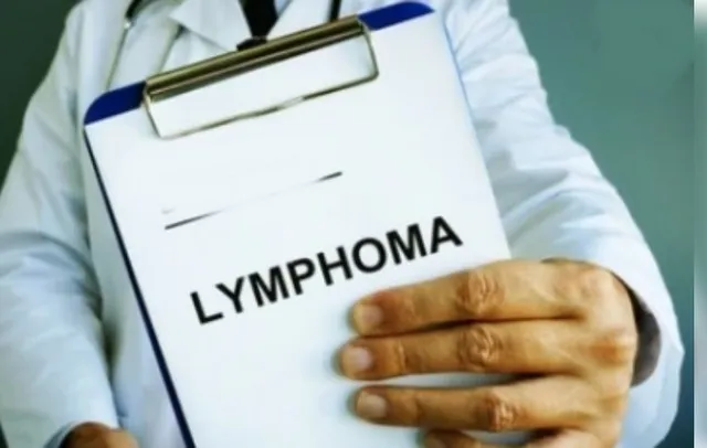 LYMPHOMA AND DOCTOR