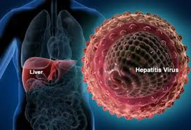 VIRAL HEPATITIS, THE SILENT KILLER