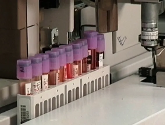 India-born scientist's team develops blood test for early cancer detection