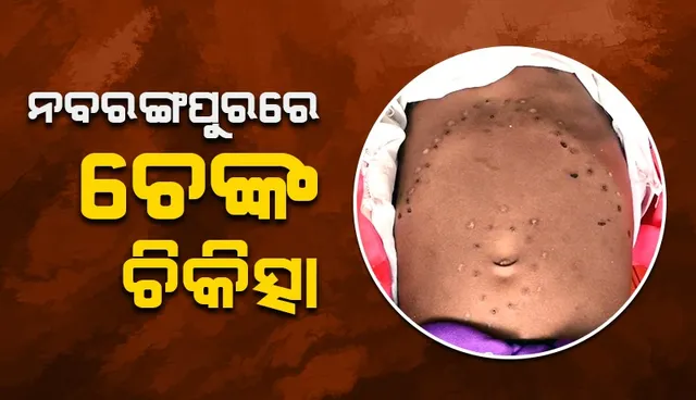 Traditional treatment