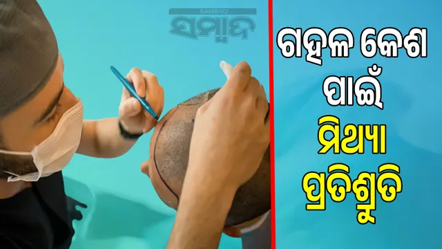 Hair transplant, beauty treatment: Fake doctors are robbing people