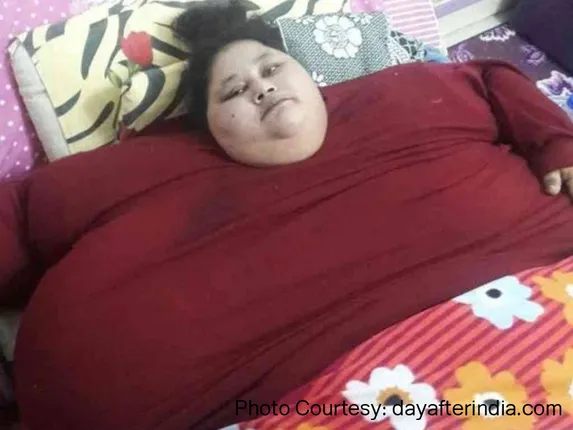 ବିଶ୍ୱର ସବୁଠାରୁ ଓଜନିଆ ମହିଳା ଏମାନ ଅହମ୍ମଦଙ୍କ ପରଲୋକ