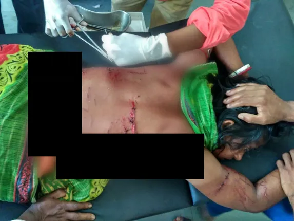 କୁମ୍ଭୀର ଆକ୍ରମଣରେ ମହିଳା ଗୁରୁତର, ହସ୍ପିଟାଲରେ ଭର୍ତ୍ତି