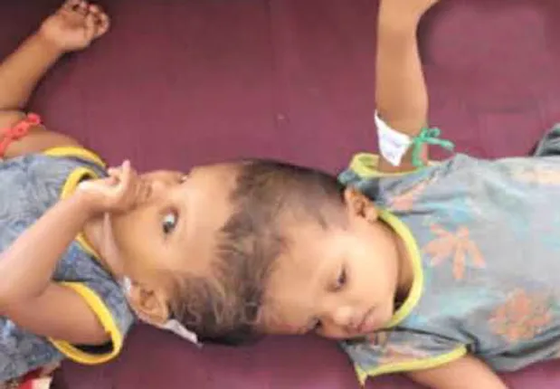 ନଭେମ୍ବରରେ ଜଗା-ବଳିଆଙ୍କ ଦ୍ୱିତୀୟ ପର୍ଯ୍ୟାୟ ଅସ୍ତ୍ରୋପଚାର