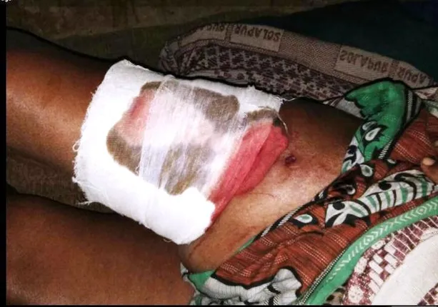 କୁମ୍ଭୀର ଆକ୍ରମଣରେ ମହିଳା ଗୁରୁତର