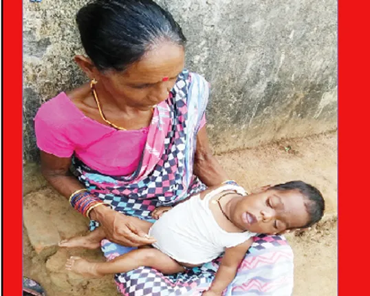 ୫ବର୍ଷ ଶିଶୁର ଦାନ୍ତ ବାହାରୁନି, ଶରୀର ବଢ଼ୁନି