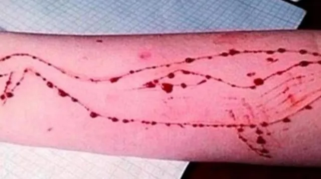 ‘ବ୍ଲୁ ହେ୍ଵଲ୍‌’ ବିପଦ୍‌ ଟାଳିବାକୁ ଭାରତକୁ ସାହାଯ୍ୟ କରିବ ରୁଷୀୟ ସରକାର