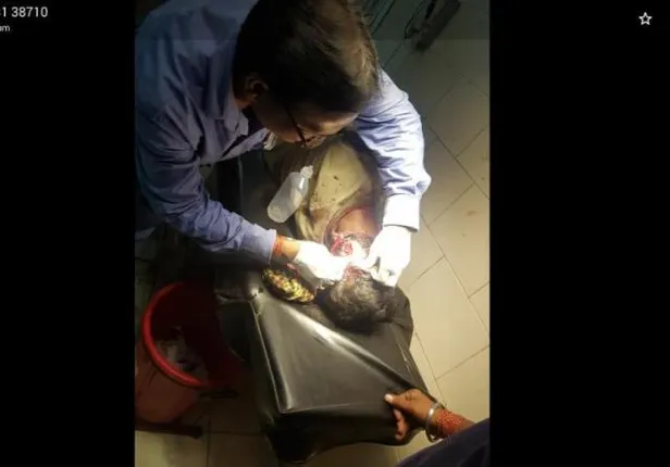 ନାଲକୋ ନଗର: ଅଟୋକୁ ପଛରୁ ପିଟି ବାଇକ ଚାଳକ ଗୁରୁତର, ହସ୍ପିଟାଲରେ ଭର୍ତ୍ତି