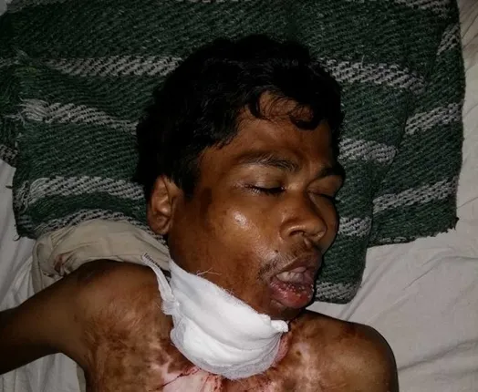 ଜେଲ୍‌ରେ କଏଦୀର ଆତ୍ମହତ୍ୟା ଉଦ୍ୟମ : ଗୁରୁତର ଅବସ୍ଥାରେ ଡାକ୍ତରଖାନାରେ ଭର୍ତ୍ତି