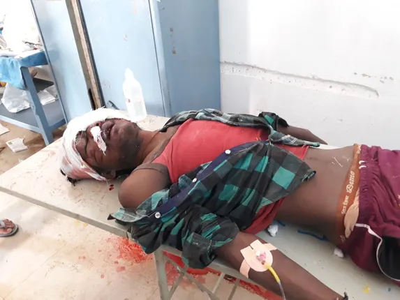 ନୂଆପଡ଼ା: ବାଇକ-ପିକ୍‌ଅପ୍‌ ମୁହାଁମୁହିଁ ଧକ୍କା, ଜଣେ ମୃତ ଓ ୪ ଆହତ