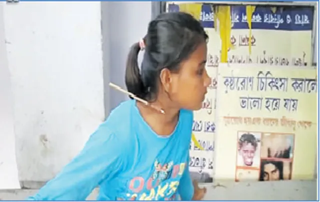 ବେକରେ ପଶିଲା ତୀର:ଅଳ୍ପକେ ବର୍ତିଲେ ଉଦୀୟମାନ ତୀରନ୍ଦାଜ