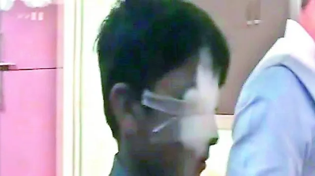 ଶିକ୍ଷକଙ୍କ ଚାପୁଡ଼ା ଖାଇ ଅନ୍ଧ ହୋଇଗଲା ସ୍କୁଲ୍‌ ବାଳକ