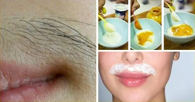 ଘରୋଇ ଉପାୟରେ ଆପଣଙ୍କର ଓଠର ଉପରିଭାଗରୁ କେଶ ହଟାନ୍ତୁ