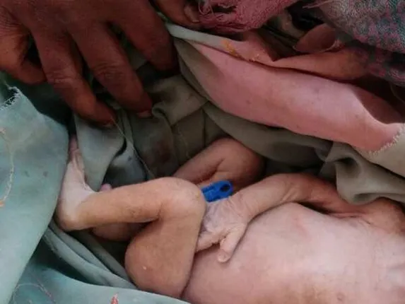 ହସ୍ପିଟାଲ ବାଥ୍‌ରୁମ୍‌ରେ ମହିଳାଙ୍କ ପ୍ରସବ, ନର୍ସର ଅବହେଳା ହେତୁ ନବଜାତ ଶିଶୁର ହେଲା ମୃତ୍ୟୁ