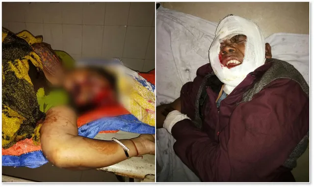 ରାୟଗଡ଼ା: ସଡ଼କ ଦୁର୍ଘଟଣାରେ ମହିଳା ମୃତ, ମାମୁଁ-ଭାଣଜୀ ଆହତ