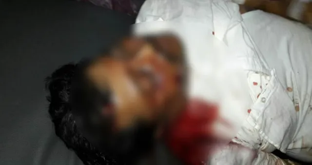 ଗଞ୍ଜାମ: ଗୁଳିମାଡ଼ରେ ବସ୍‌ ମାଲିକ ଗୁରୁତର, ଏମ୍‌କେସିଜିକୁ ସ୍ଥାନାନ୍ତର