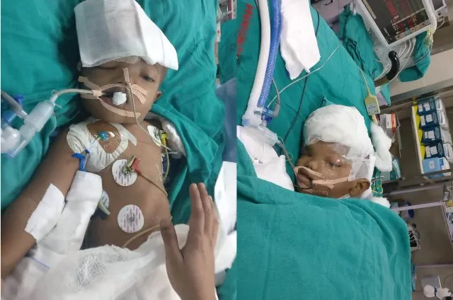 ବଳିଆର ଚେତା ଫେରିନି, ଡାକ୍ତରୀଦଳ ଚିନ୍ତିତ