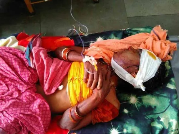 ମହିଳାଙ୍କୁ ଭୁଜାଲିରେ ହାଣି ଲୁଟ୍‌