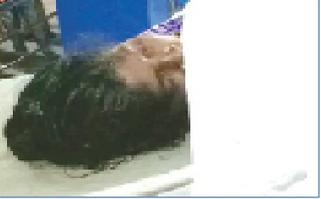 ପ୍ରସବ ପାଇଁ ଆସିଥିବା ମହିଳାଙ୍କ ମୃତ୍ୟୁ