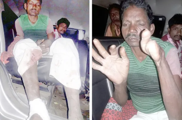 ଭିନ୍ନକ୍ଷମ ଶ୍ରମିକଙ୍କୁ ଦାଦନ ସର୍ଦ୍ଦାରଙ୍କ ଛୁରାମାଡ଼