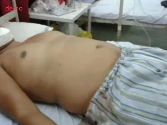 ପତ୍ନୀ ବିଷୟରେ ଅଶ୍ଳୀଳ କଥା କହୁଥିଲା, ମନା କରିବାରୁ ସାଙ୍ଗର ଗୁପ୍ତାଙ୍ଗ କାଟିଲା ଯୁବକ