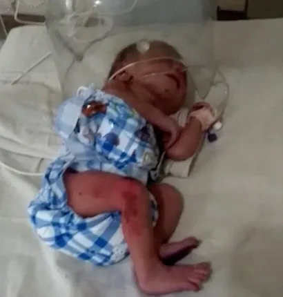 ମୃତ ଭାବି ଶିଶୁକୁ ଶ୍ମଶାନ ନେଉଥିଲେ, ବାଟରେ ହେଲା ଏମିତି ଚମତ୍କାର !