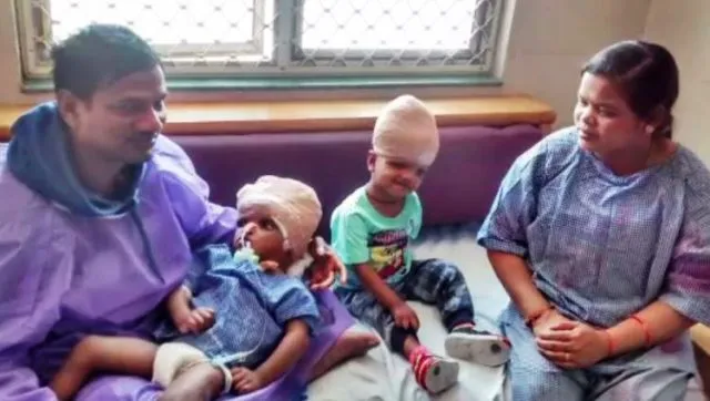 ବଳିଆକୁ ଜ୍ୱର