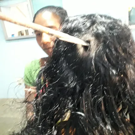 ତୀର ମାଡ଼ରେ ମହିଳା ଗୁରୁତର