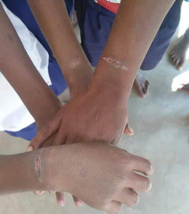 ପୁଣି ଶିଶୁଙ୍କୁ ଚେଙ୍କ