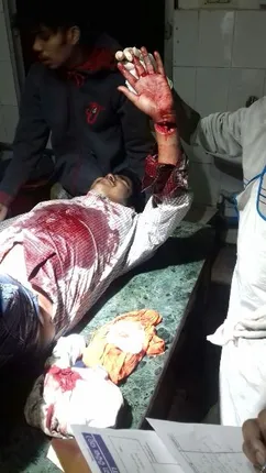 ବିରୋଧ କରିବାରୁ ହାଣିଲେ ଦୁର୍ବୃତ୍ତ