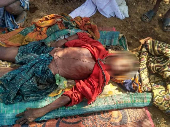 କୋଠା ସେଣ୍ଟ୍ରିଂ ଛୁଇଁଦେବାରୁ କୁଷ୍ଠରୋଗୀଙ୍କୁ ହତ୍ୟା