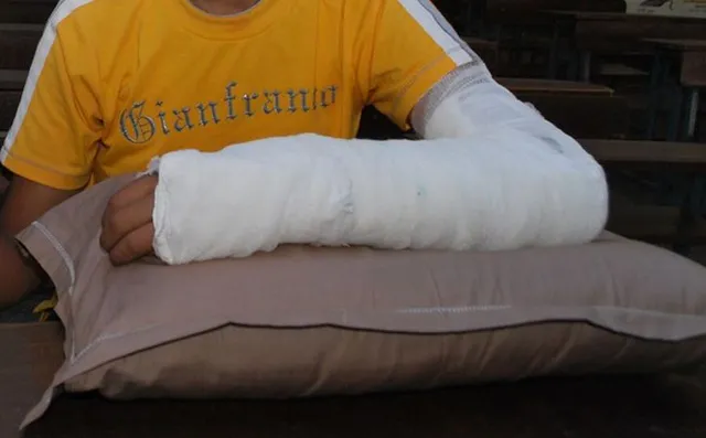 ହସ୍‌ପିଟାଲକୁ ଭଙ୍ଗା ହାତର ଅସ୍ତ୍ରୋପଚାର ପାଇଁ ଯାଇଥିବା ବାଳକ ମୃତାବସ୍ଥାରେ ଘରକୁ ଫେରିଲା