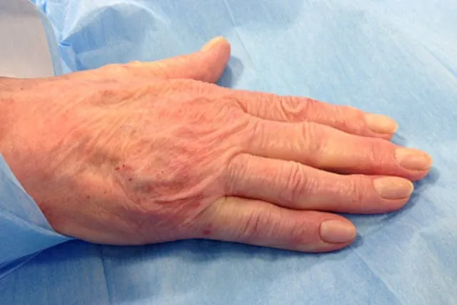 ହାତର ମଧ୍ୟମ ଆଙ୍ଗୁଳିରୁ ଜାଣନ୍ତୁ , ଭବିଷ୍ୟତରେ ଆପଣଙ୍କର କ’ଣ ଘଟିପାରେ !