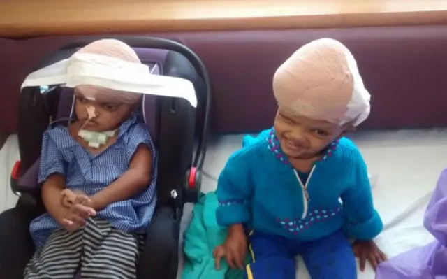 ବଳିଆର ଖପୁରିରେ ଚର୍ମ ପ୍ରତିରୋପଣ