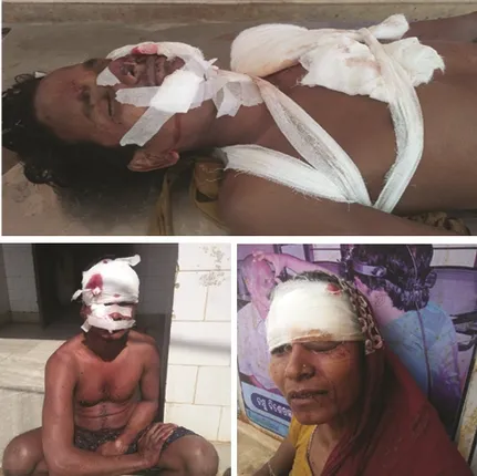 ଜମିବାଡି ବିବାଦ : ଯବାନଙ୍କ ଗୁଳିମାଡ଼ରେ ୩ ଗୁରୁତର