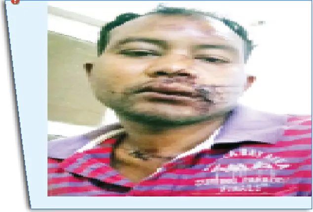 ଟ୍ରେଲର୍‌ ସହ ମୁହାଁମୁହିଁ ଧକ୍କା ଏଡ଼ାଇବାକୁ ବ୍ରେକ୍‌ ଦେଇଥିଲି: ଚାଳକ