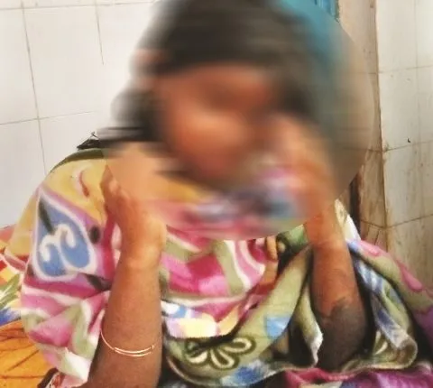 ଏସ୍‌ସିବିରେ କଳାହାଣ୍ଡି ଏସିଡ୍‌ ପୀଡ଼ିତା