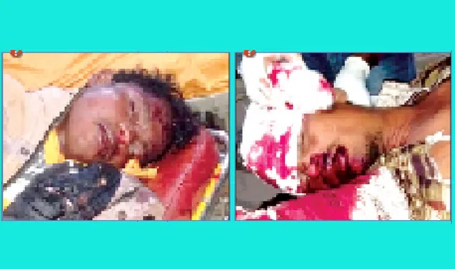 ଟ୍ରକ-ବାଇକ ଧକ୍କା, ଦୁଇ ଗୁରୁତର