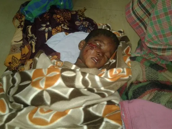 କୁନି ମୁଣ୍ଡରେ ଏତେ ରାଗ!